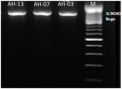 Antibiotic-resistant bacteria in hospital wastewater treatment plant effluent and the possible consequences of its reuse in agricultural irrigation